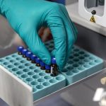 Crisis silenciosa: laboratorios públicos en Venezuela operan con 80% de déficit de insumos